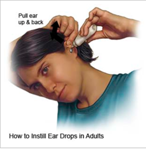 После закапывания в ухо. Закапывание лекарства в ухо. Последовательность закапывание в уши. Как правильно капать в уши. Как правильно капать капли в уши взрослому.